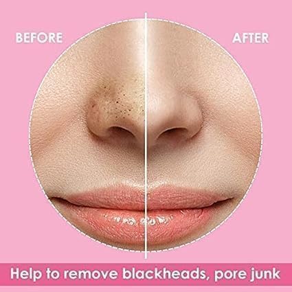 LAKYOU BEAUTY Charcoal Nose Pore Strips Cleansing (Removes Blackheads and Unclogs Pores, 10 Strips in Pack of 1 - Image 6