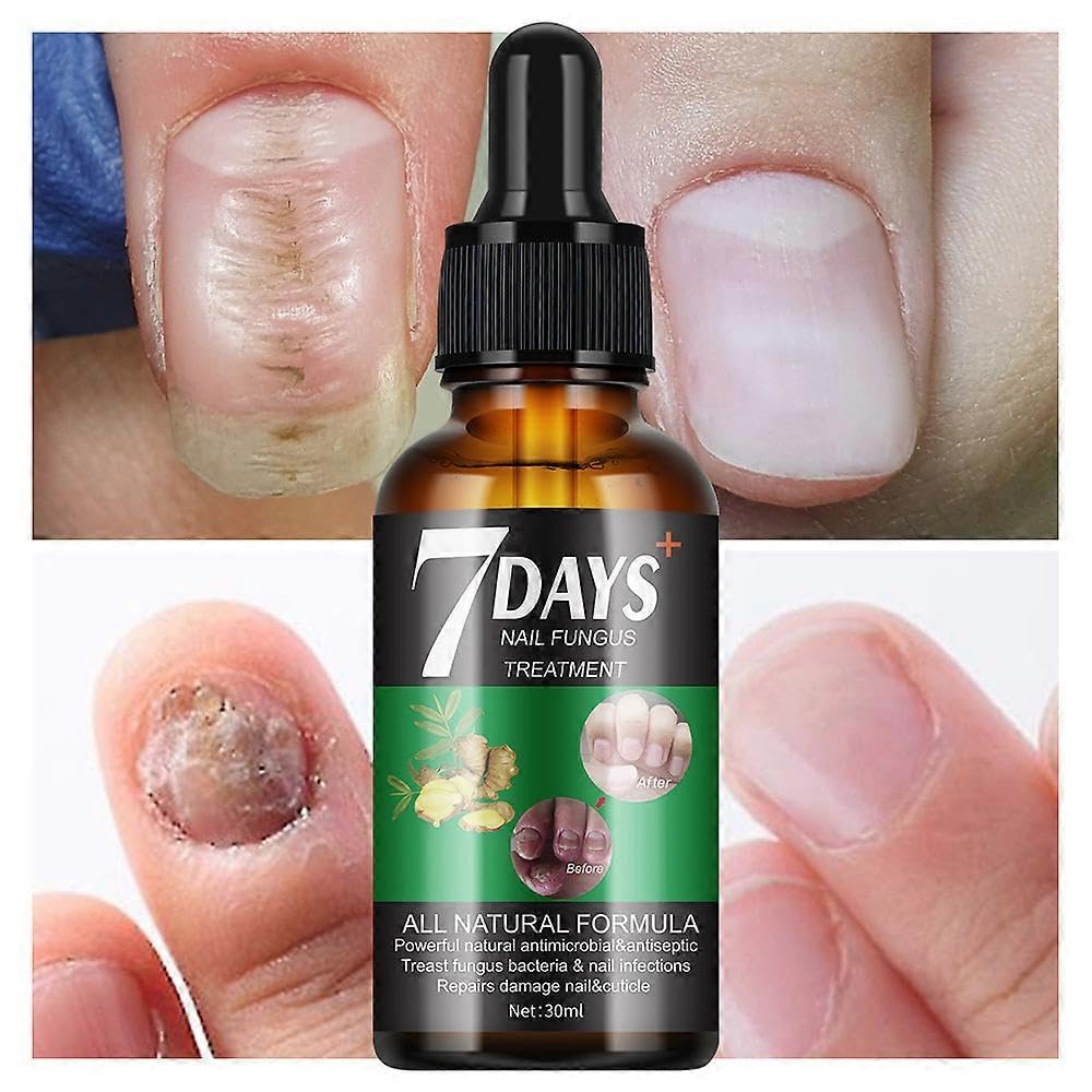 NAILWIND Nail Repair Cuticle Oil for Nails, Natural Oils, 30ml, Nail Strengthener Serum Nail Growth Oil Nourishing Moisturizing and Clear Texture, Non-sticky | Pack of 1 - Image 2
