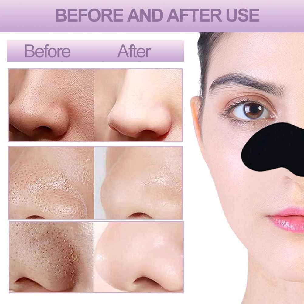LAKYOU BEAUTY Charcoal Nose Pore Strips Cleansing (Removes Blackheads and Unclogs Pores, 10 Strips in Pack of 1 - Image 7