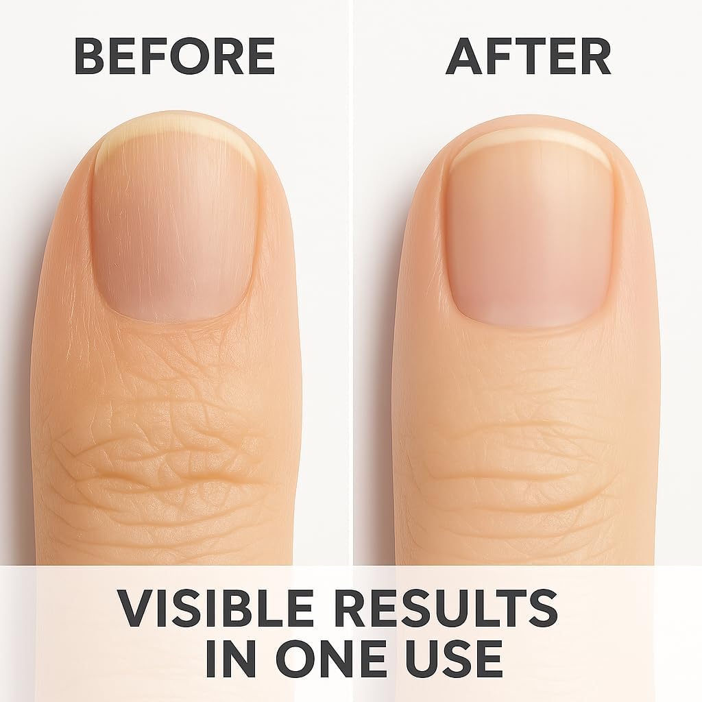 NAILWIND Cuticle Softener, Cuticle Softener for Nails, Professional Nail Care with Lanolin for Brittle Hang Nails, Hydrating, Moisturizing, Dry Cuticles,100ml - Image 5