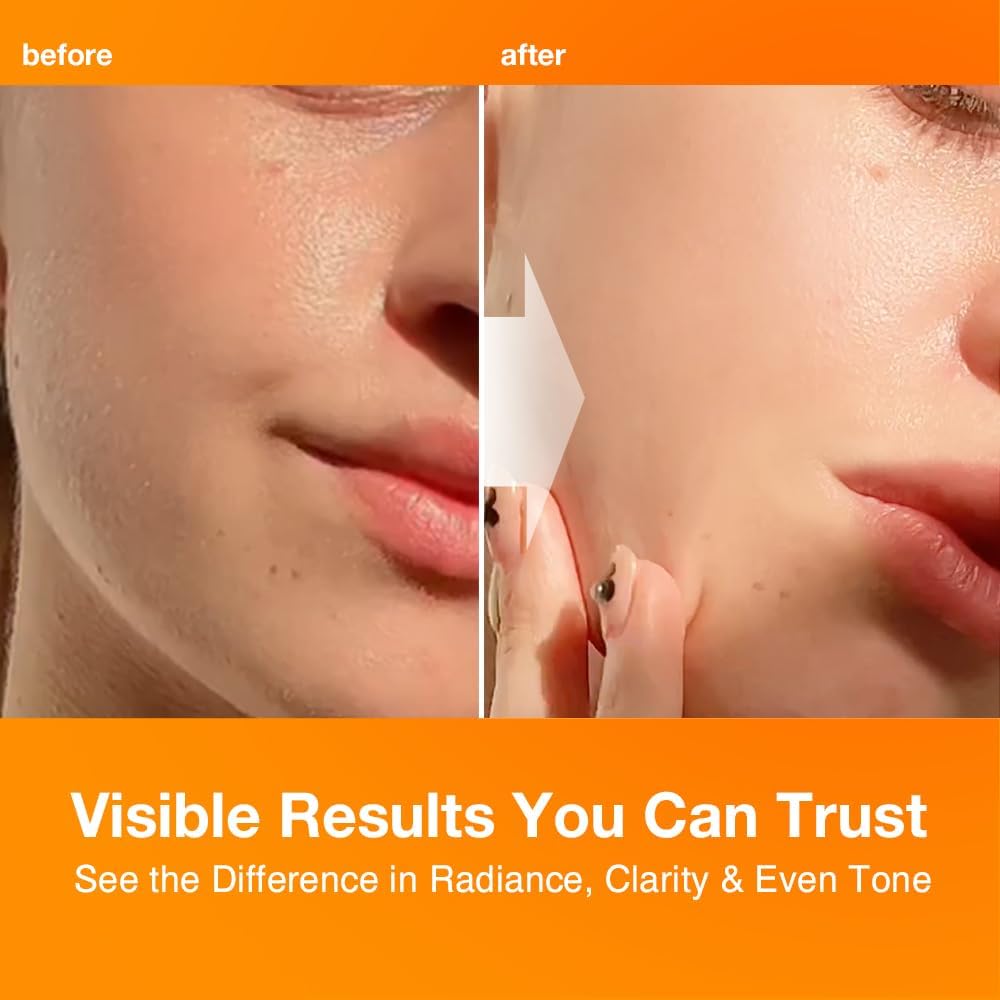 My Colors Vitamin C Face Serum | For Brightening & Anti-Aging | Men & Women 50 ml - Image 2