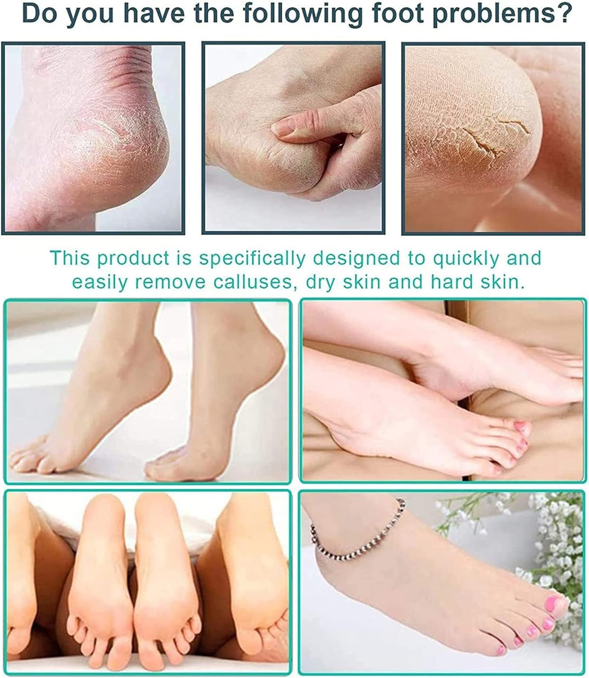 NAILWIND Nail and Foot Care Kit - Easy Callus Removal - Professional Beauty Tools, Pedicure Tools for Feet - 8 in 1 Pedicure Kit | Foot Scrubber for Dead Skin, Callus Remover, Foot Scraper, Foot File, Pitchfork, Filer for Nail Repair - 1 Set - Image 4