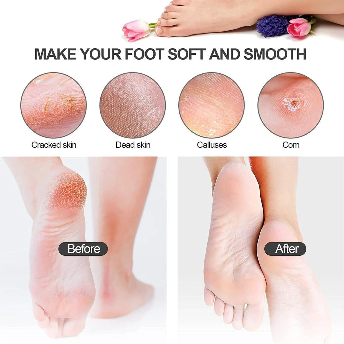 Cosluxe foot rasp foot file and Callus remover. Best Foot care pedicure metal surface tool to remove hard skin. Can be Used on both wet and dry feet, Surgical grade stainless steel file - Image 5
