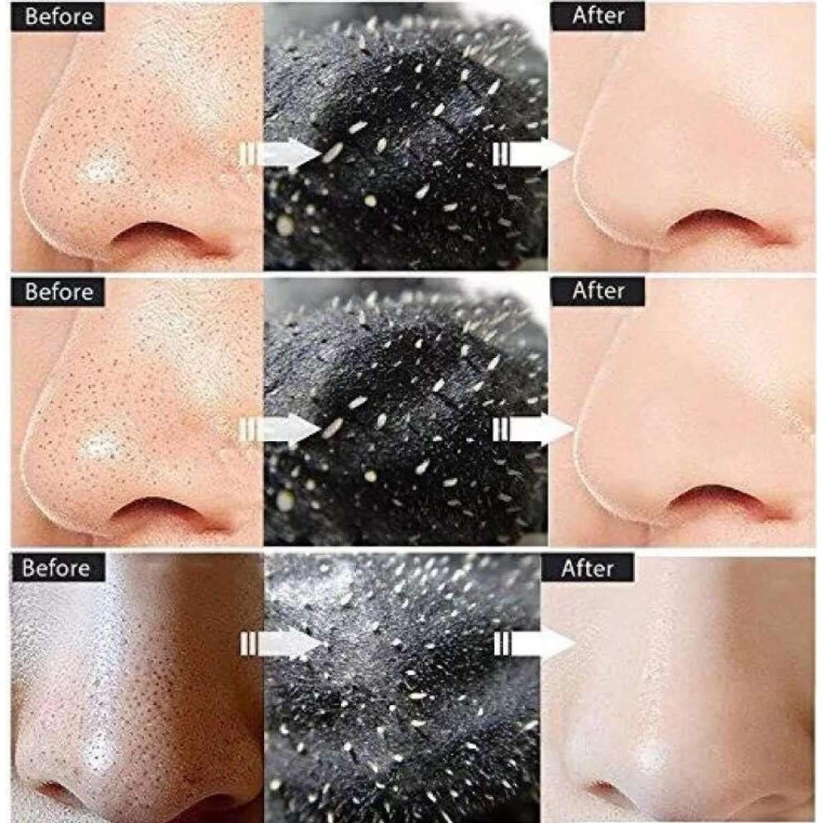 Nose Strips,Pore Strips for Blackheads,Vitamin C Nose Strip With Hazel Extracts Observes Dirt And Oil - for MEN & WOMEN 10 Strips in Pack of 1 - Image 7