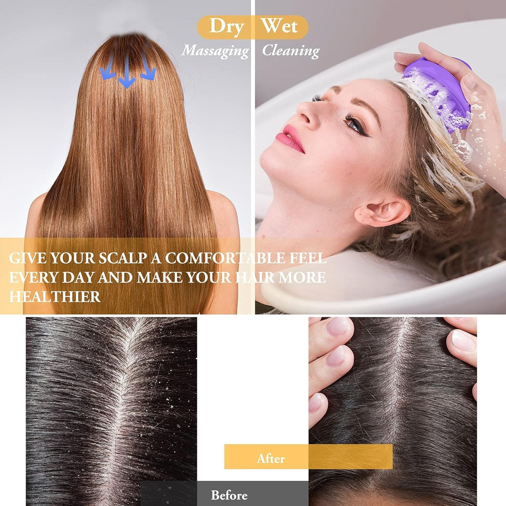 COSLUXE Scalp Massage, Scalp Massager, Head & Hair Massagers For Hair Growth for Dry Massage, Oil & Shampoo - Image 4